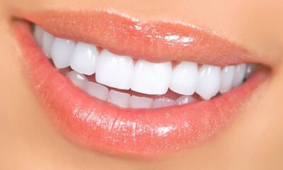 Fațete dentare vs. Coroane dentare