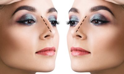 Operația de rinoplastie. Află cum poți scăpa de nasul borcănat