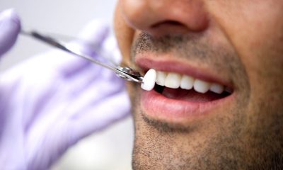 Cum ar trebui sa isi protejeze tinerii dintii?