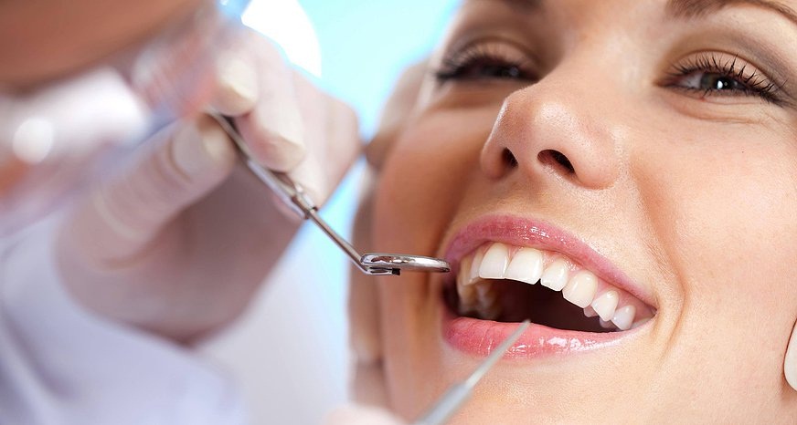 Ce variante ai in materie de coroane dentare?