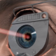 Se poate trata astigmatismul cu operatie laser?