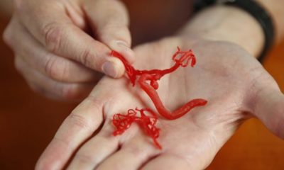 Medicii cred că vasele sangvine imprimate 3D pot ajuta la tratarea bolilor cardiovasculare