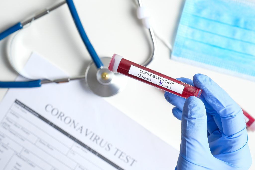 Încă o persoană a murit din cauza coronavirusului în Italia, la câteva ore după anunțarea primului deces. Numărul persoanelor infectate crește alarmant