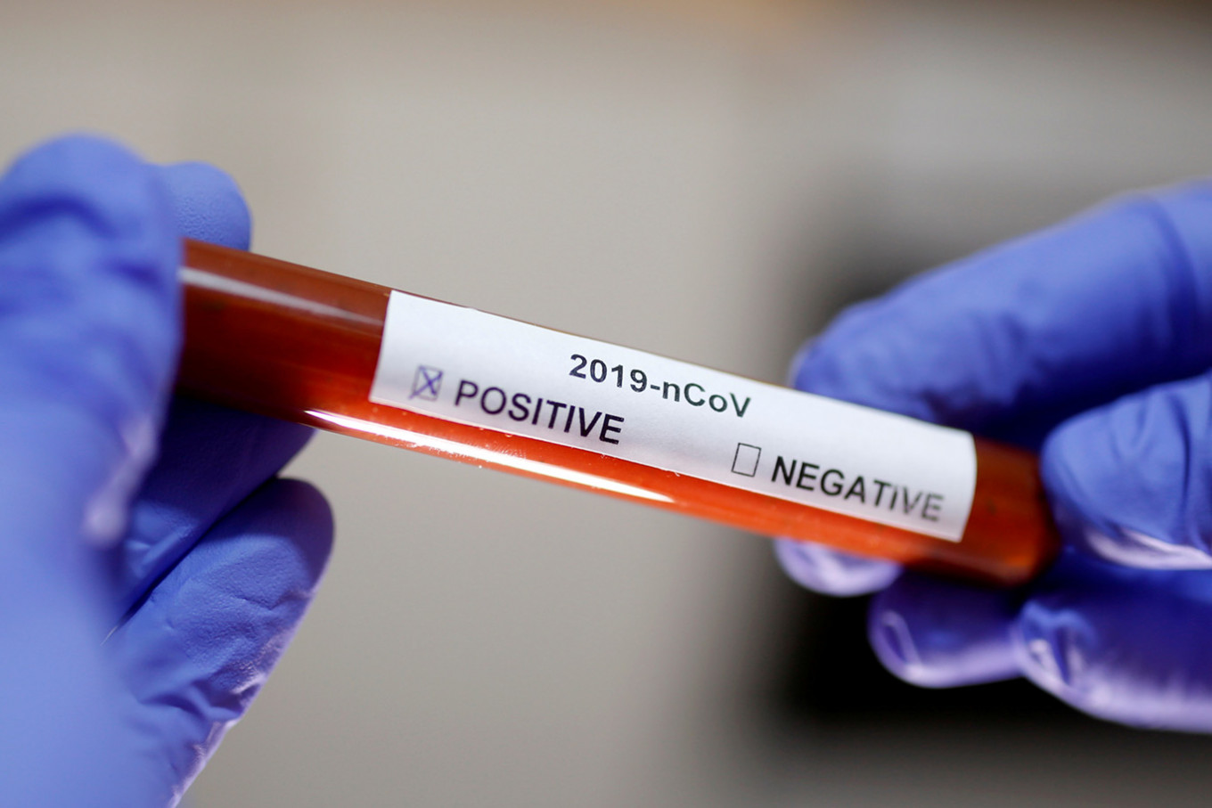 CORONAVIRUS. Focar de infecție la SJU Miercurea-Ciuc. Încă 6 angajați au fost testați pozitiv, iar numărul celor infectați a ajuns la 13