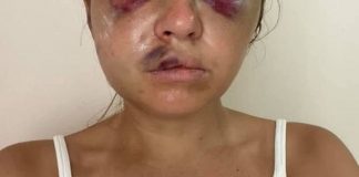 Vedetă TV, mutilată de un bărbat care a vrut să o violeze în fața fiului ei de șase ani. Cum a scăpat tânăra de 28 de ani din mâinile brutei