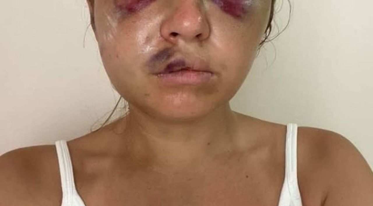 Vedetă TV, mutilată de un bărbat care a vrut să o violeze în fața fiului ei de șase ani. Cum a scăpat tânăra de 28 de ani din mâinile brutei