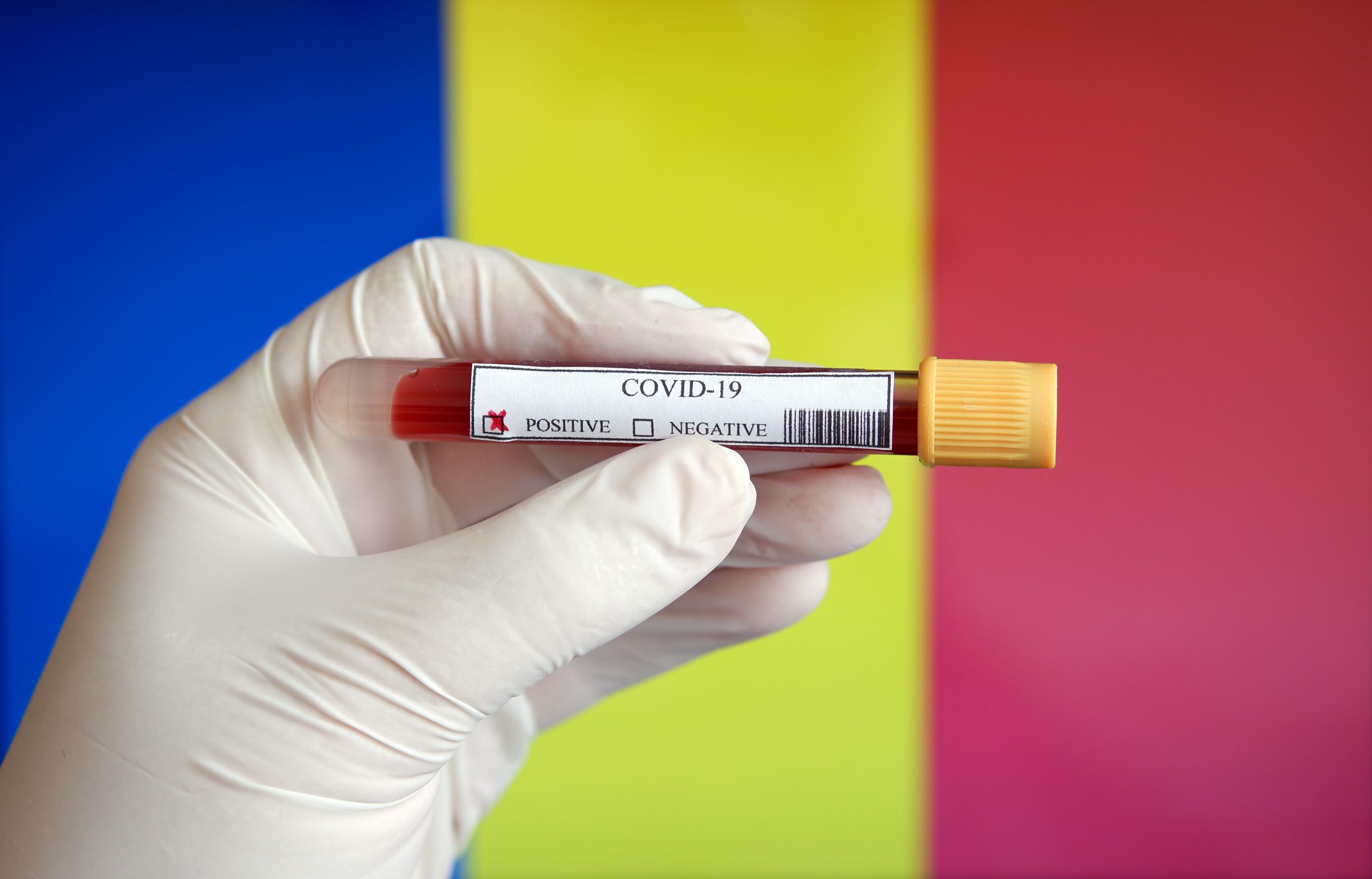Bilanț coronavirus 2 octombrie. Record de cazuri noi de COVID-19 în ultimele 24 de ore