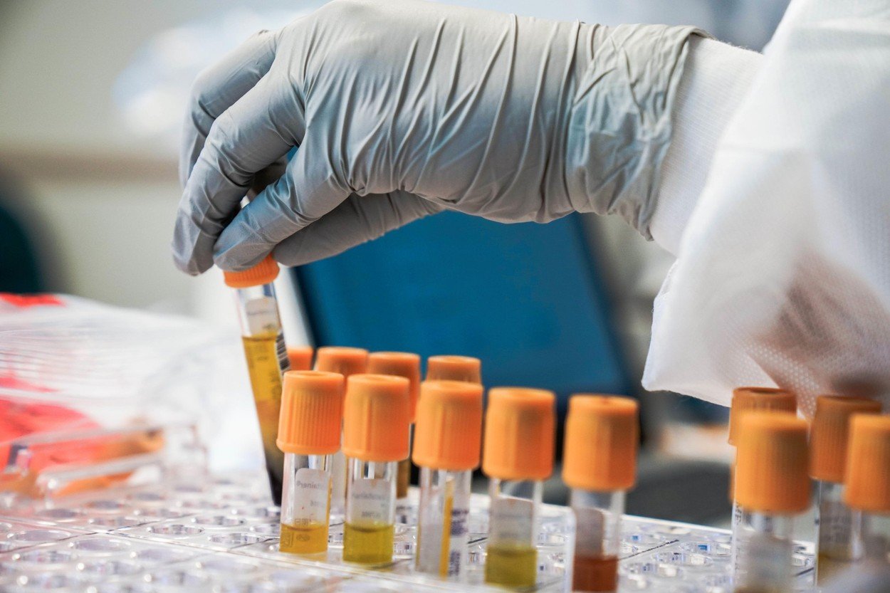 Virusul care alertează autoritățile din Ghana: S-au înregistrat primele cazuri de infectare cu Marburg