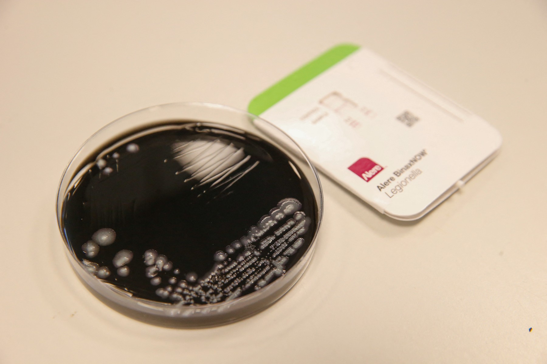 Pneumonia provocată de o bacterie legionella a ucis a cincea persoană în Argentina