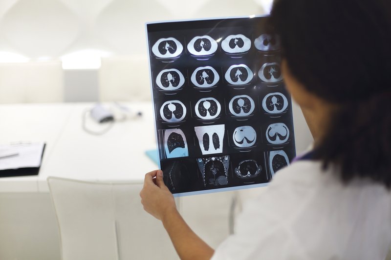 Strategia Națională de Control al Tuberculozei, aprobată de Guvern