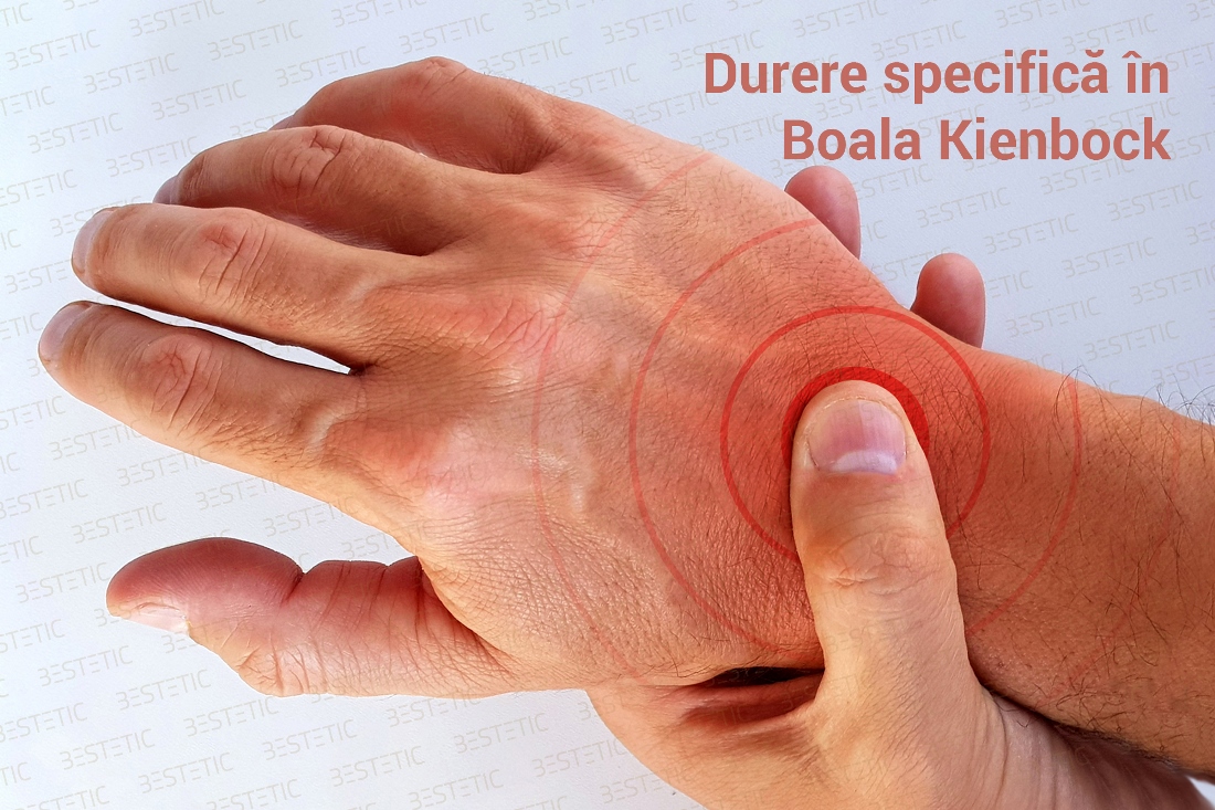 Sindromul de tunel carpian sau boala Kienbock?