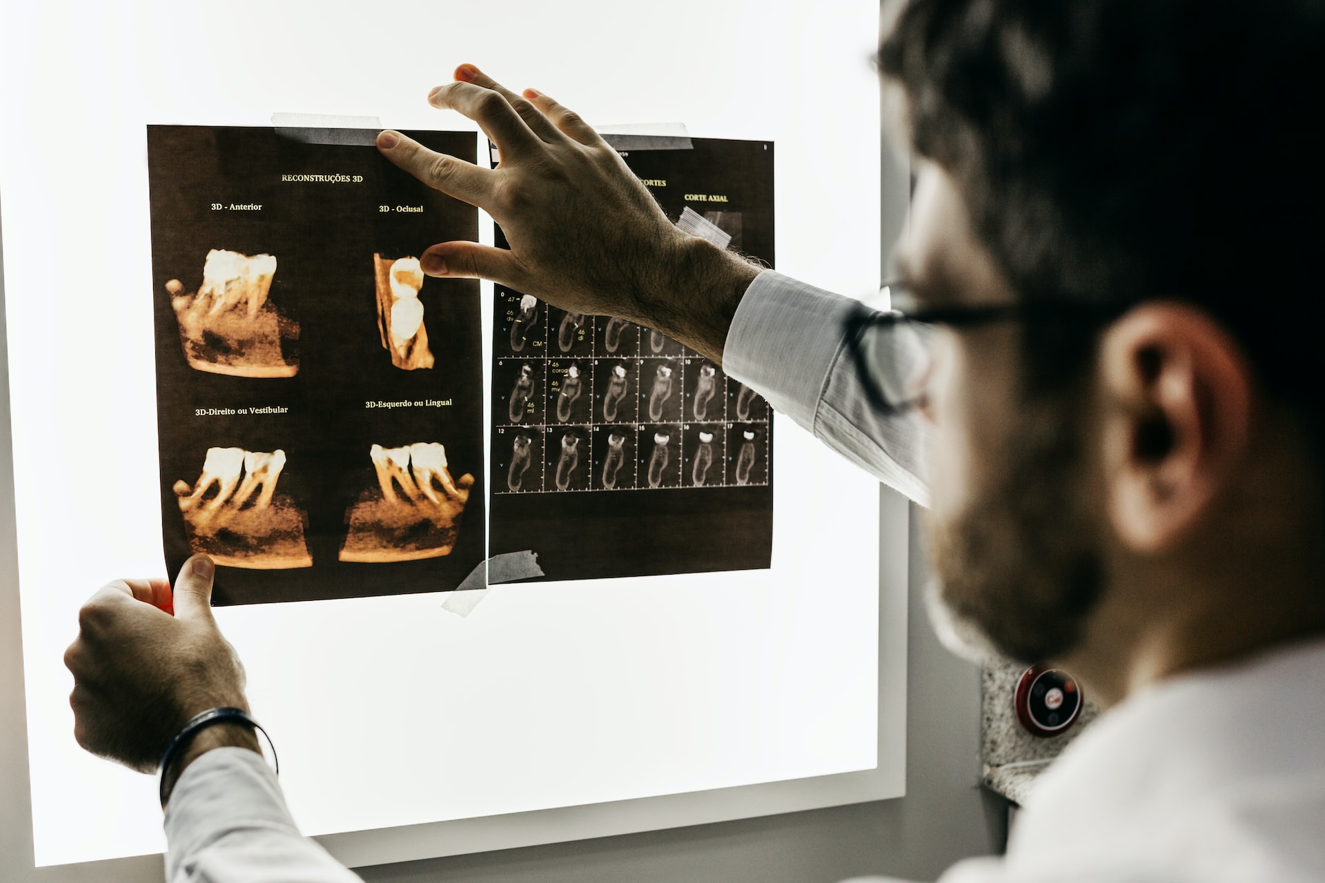 Informatii esentiale pe care trebuie sa le cunosti atunci cand doresti sa obtii un implant dentar. Ce spun specialistii anului 2022?