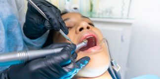 unui implant dentar