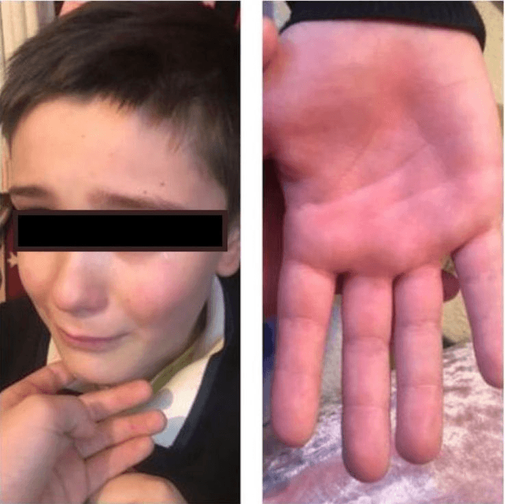 Noi detalii șocante în cazul învățătorului care a bătut un copil pentru că nu știa tabla înmulțirii. „Câte cifre, atâtea bețe la palmă”