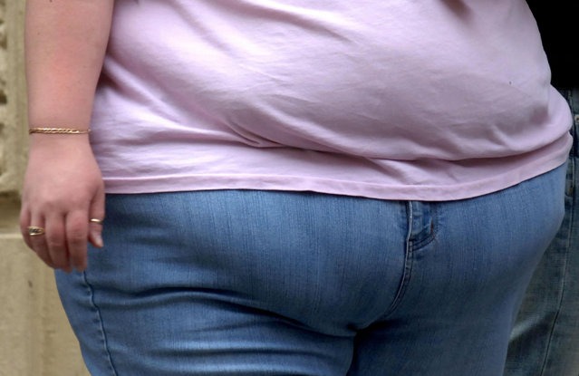 Părinţii unei fete care a murit din cauza obezităţii, acuzaţi de omor prin neglijenţă
