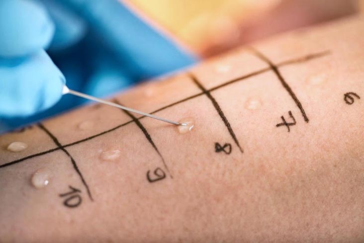 Despre Alergologie si Dermatovenerologie