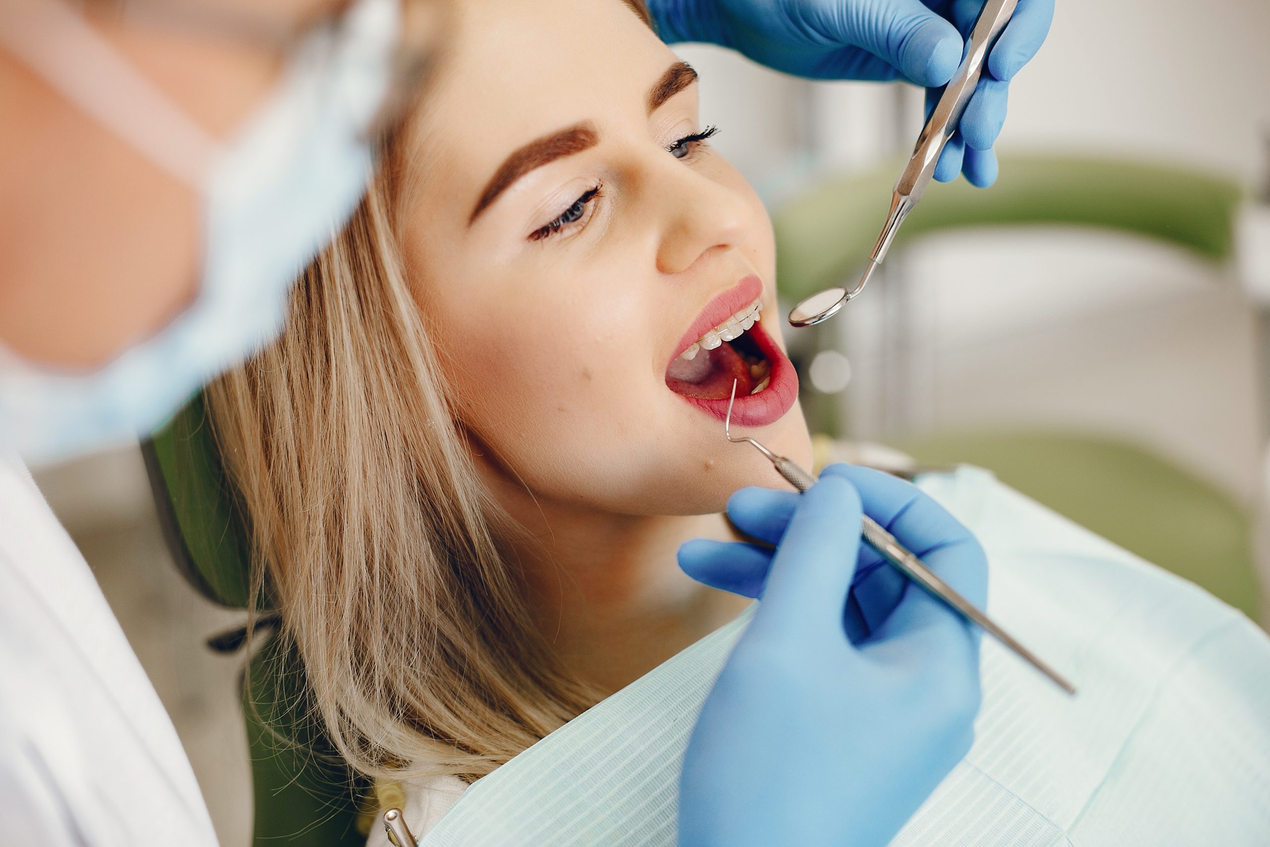 Când ai nevoie de aparat dentar? Când ai nevoie de aparat dentar?