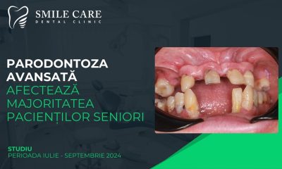 Studiu Smile Care: parodontoza avansată afectează majoritatea pacienților seniori, iar proteza fixă pe implanturi este soluția preferată