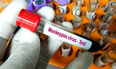 A fost depistată o nouă tulpină de variola maimuței, apărută în Congo. Este primul caz confirmat pe un alt continent decât cel african