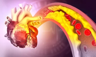 Scapă de colesterol cu patru alimente și secretul celor 150 de minute