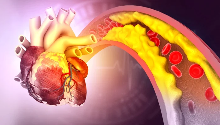 Scapă de colesterol cu patru alimente și secretul celor 150 de minute