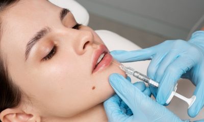 Injectări acid hialuronic: pentru buze mai mari, așa cum ți le-ai dorit mereu