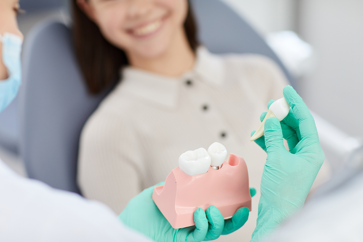 Avantajul implantului dentar față de puntea dentară Avantajul implantului dentar față de puntea dentară