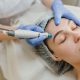 Tratamentul Hydrafacial: Secretul unui ten lipsit de imperfecțiuni