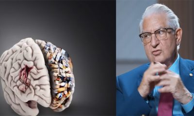 Cele 3 obiceiuri zilnice care ne distrug creierul, potrivit dr. Vlad Ciurea