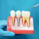 Descoperă cele mai noi proceduri de endodonție disponibile în Constanța