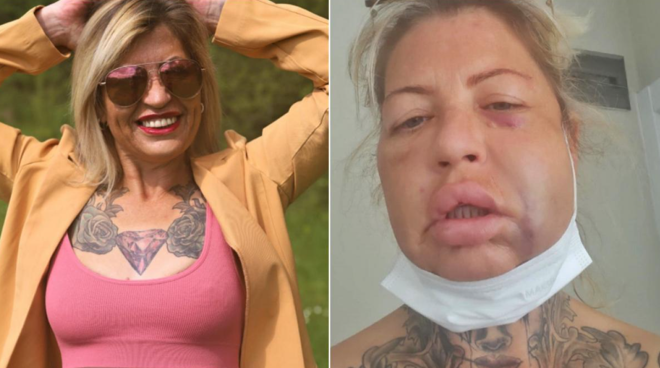 Coșmarul lui Vicky din Nottingham. Cu ce ZÂMBET te poți pricopsi cu doar 10.000 de lire sterline