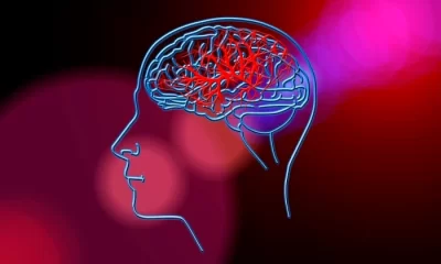 Patru obiceiuri banale de seară care trebuie evitate pentru a reduce riscul de AVC