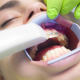 Etapele tratamentului cu aparat dentar