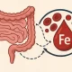 Legătura dintre intestin și deficitul de fier: Anemia prezentă chiar și cu o dietă adecvată Legătura dintre intestin și deficitul de fier: Anemia prezentă chiar și cu o dietă adecvată
