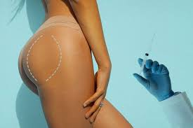 Estetică fără bisturiu avantajele măririi feselor cu acid hialuronic