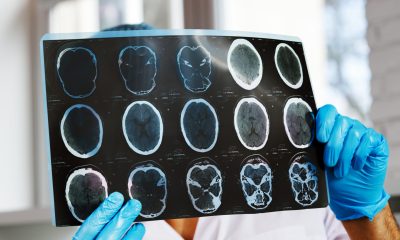 Neurologii vorbesc despre cel mai bun obicei pentru menținerea unei memorii bune după vârsta de 55 de ani. Ce ar trebui să faci zilnic