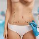 Corpul tău, regulile tale: Ghidul tău despre liposucție și abdominoplastie