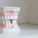 Cum se realizează corect o reconstrucție dentară pe termen lung – Dr. Durbac