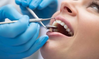 Totul Despre Procedura de Implant Dentar în Constanța