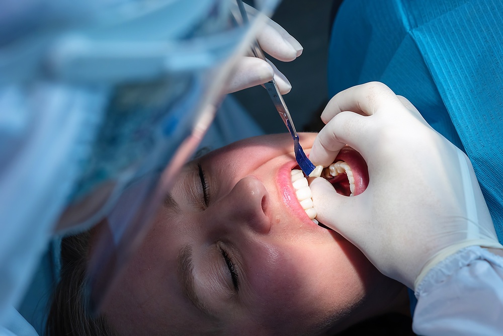 Coroane dentare sau soluții de estetică dentară? Recomandările specialistului pentru un zâmbet sănătos