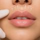Lip Lift: ce este intervenția care poate modifica proporțiile buzei superioare