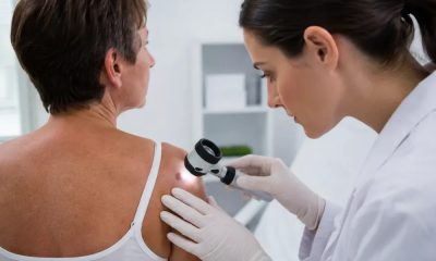 Tumori cutanate: cum le recunoști, când este necesară evaluarea medicală și ce opțiuni de tratament există