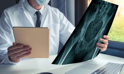 Tratament chirurgical pentru coxartroză: soluții moderne pentru durere de șold și alte afecțiuni ortopedice