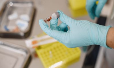 Oboseală, lipsă de concentrare, stare de spirit schimbătoare: ce se verifică în sânge la Clinica Sante