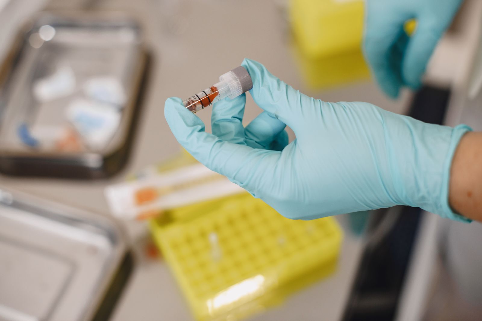 Oboseală, lipsă de concentrare, stare de spirit schimbătoare: ce se verifică în sânge la Clinica Sante