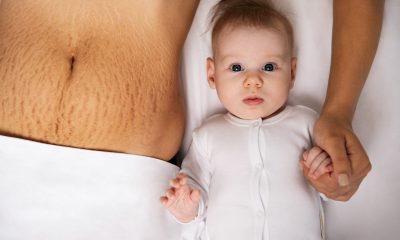 Pielea lăsată după slăbire sau sarcină? Ce soluții există și cum o alegi pe cea potrivită